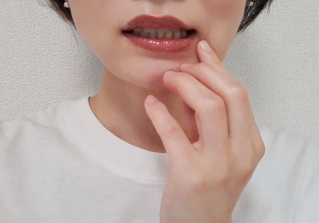 【下歯槽神経麻痺・オトガイ神経麻痺】鍼灸は効果ある?治療は?治らない?千葉県船橋市ぬくもり鍼灸院・整体院