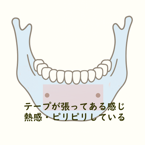 東京からも来院が多い鍼灸院・下歯槽神経麻痺はお任せください